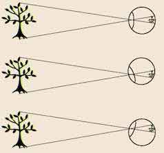 retina tree