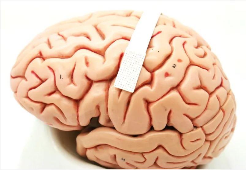 Brain with a small speech decoder implant draped over it