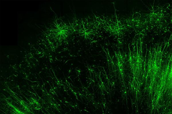  Tagging and illuminating only the inhibitory “brake” cells (green) in human brain tissue is just one of many things the new tool, CellREADR, can do. Credit – Derek Southwell, Duke University Tagging and illuminating only the inhibitory “brake” cells (green) in human brain tissue is just one of many things the new tool, CellREADR, can do.