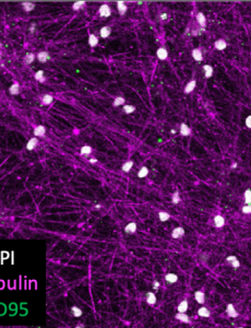 Neurons