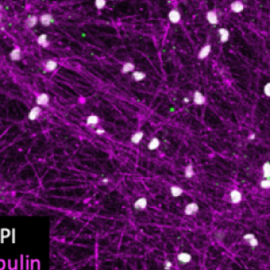 Neurons