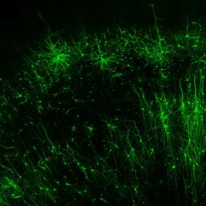  Tagging and illuminating only the inhibitory “brake” cells (green) in human brain tissue is just one of many things the new tool, CellREADR, can do. Credit – Derek Southwell, Duke University Tagging and illuminating only the inhibitory “brake” cells (green) in human brain tissue is just one of many things the new tool, CellREADR, can do.