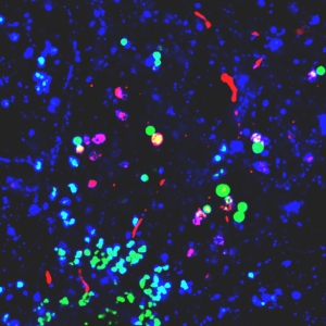 Green plastic nanoparticles co-mingling with red proteins in neuronal lysosome