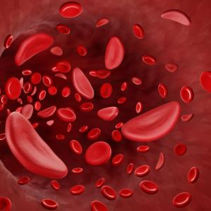 Sickle cells passing through a blood vessel